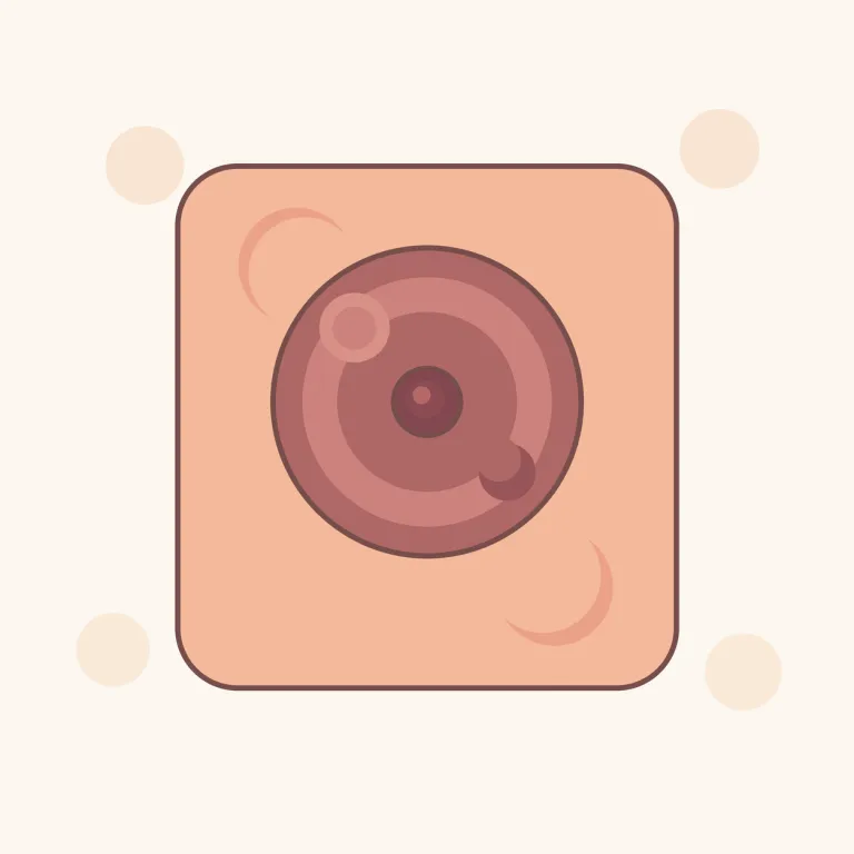 areola（乳輪・名詞）の覚え方イラスト — areola は、まずよく知っている area「面積・範囲」を思い出すと定着しやすい語です