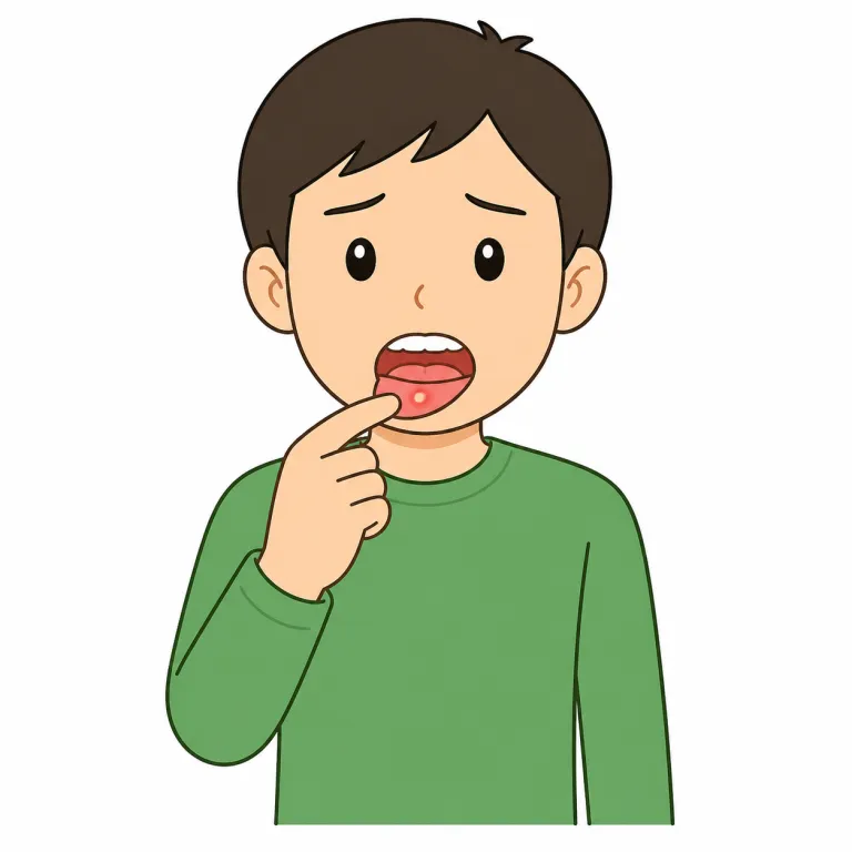 canker（かいよう・noun）の覚え方イラスト