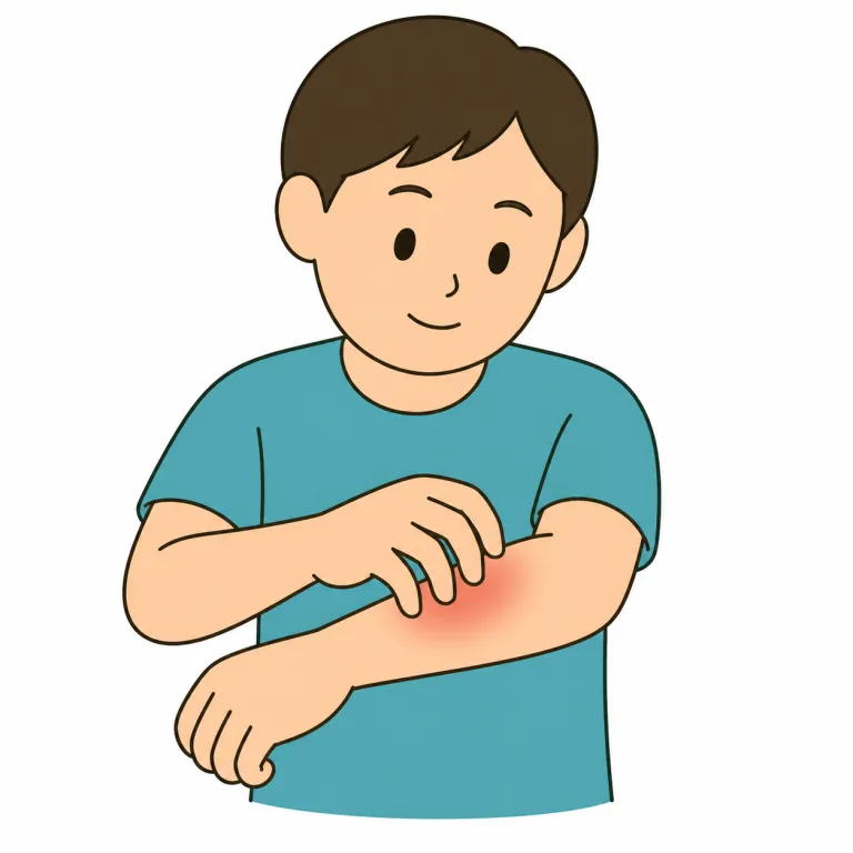 itchiness（かゆみ・noun）の覚え方イラスト