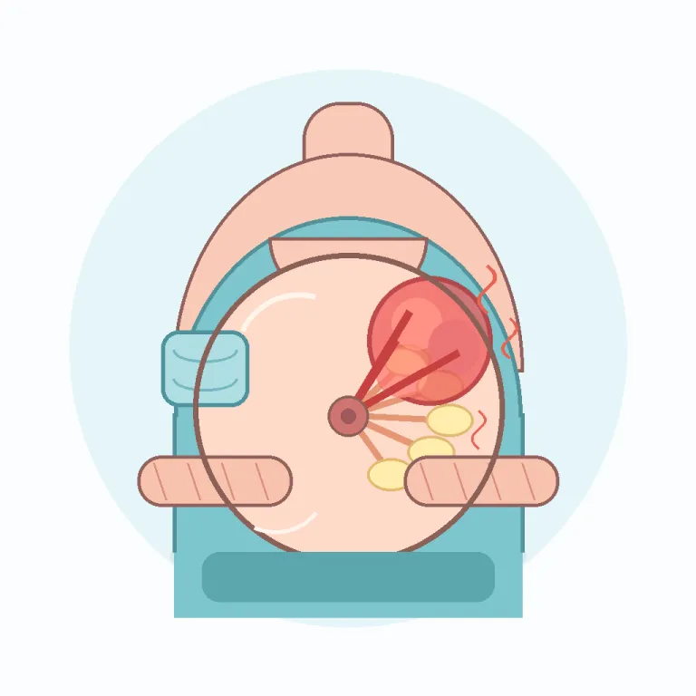 mastitis（乳腺炎・名詞）の覚え方イラスト — このエントリでは mastitis を「乳腺炎」として覚える