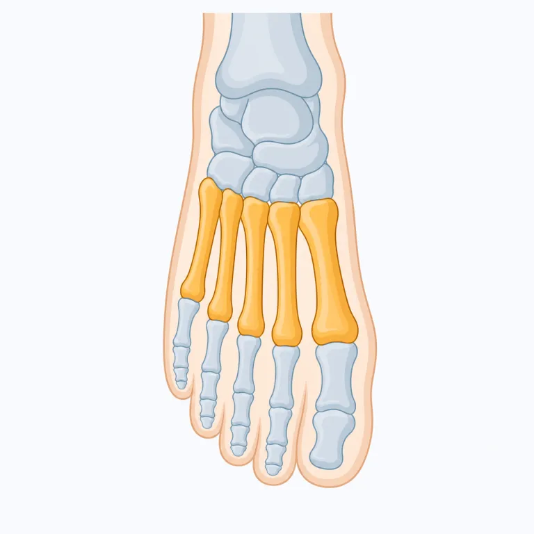 metatarsal（中足骨の・形容詞）の覚え方イラスト — 単独で覚えるより、metatarsal fracture / pain / stress injury の形で「足の甲まわりの骨のけが・痛み」と場面ごと覚えると定着しやすい
