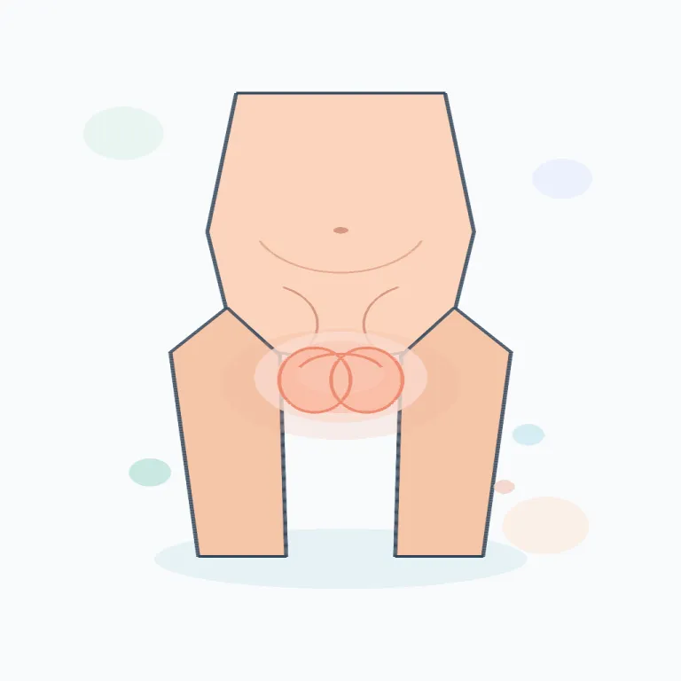 scrotal（陰嚢の／陰嚢に関する・形容詞）の覚え方イラスト — まず scrotum が「陰嚢」という名詞で、scrotal は -al が付いた「〜に関する」という形容詞だとセットで覚えると定着しやすい